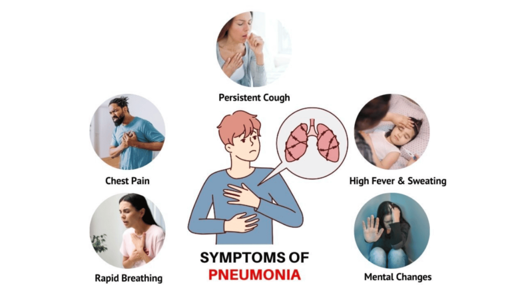 Common Symptoms of Pneumonia