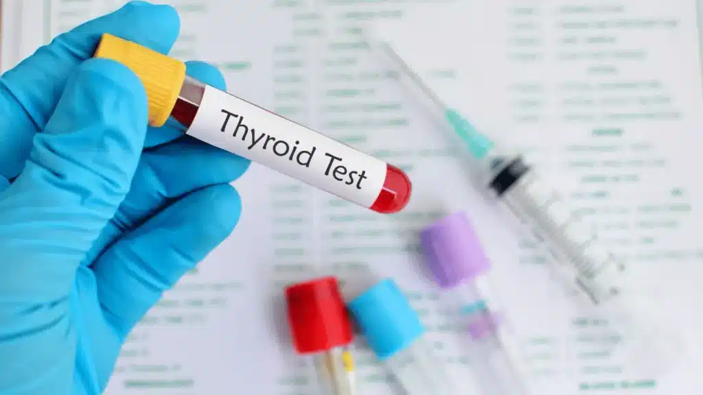 thyroid-test-panel-at-saline-bali-clinic
